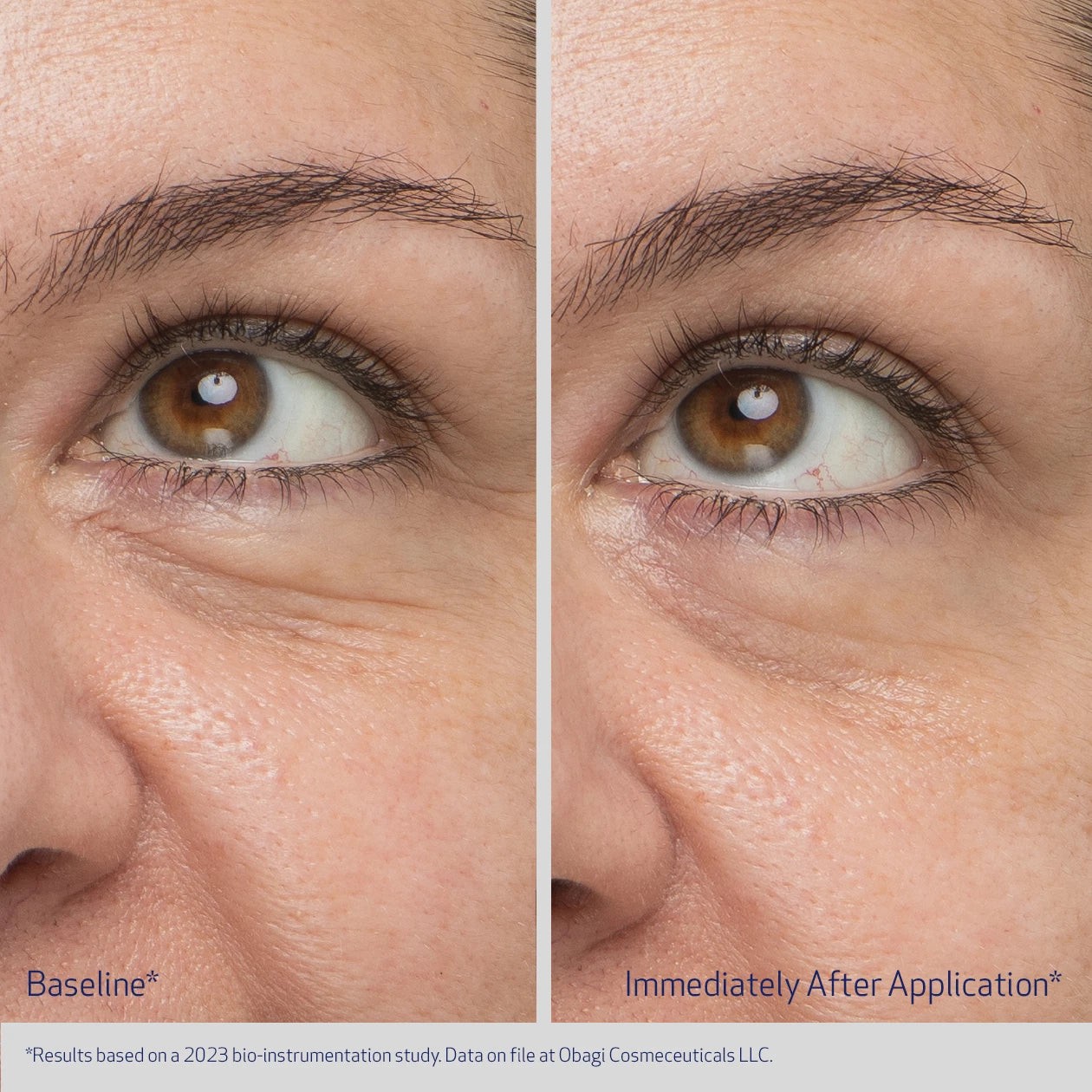 DAILY HYDRO-DROPS ELASTIDERM REJUVENATING EYE GEL CREAM BEFORE AND IMMEDIATELY AFTER APPLICATION | VISIBLY IMPROVEMENT IN SKIN BRIGHTNESS, PUFFINESS, AND FINE LINES | PARTICIPANT 1