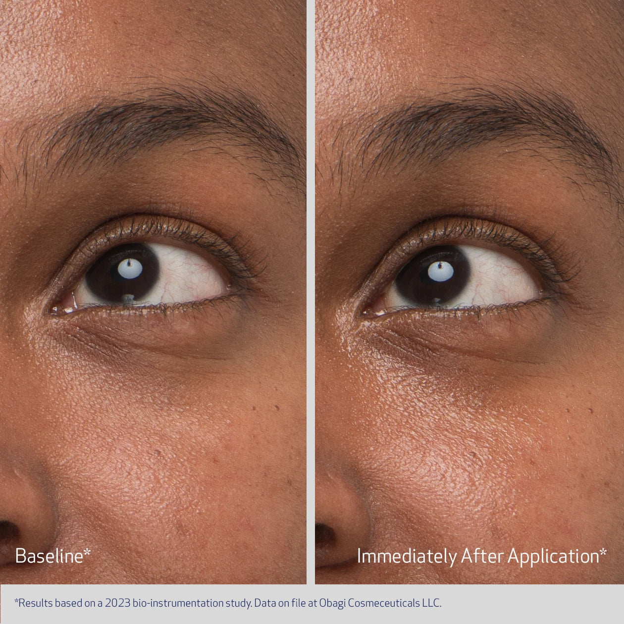 DAILY HYDRO-DROPS ELASTIDERM REJUVENATING EYE GEL CREAM BEFORE AND IMMEDIATELY AFTER APPLICATION | VISIBLY IMPROVEMENT IN SKIN BRIGHTNESS, PUFFINESS, AND FINE LINES | PARTICIPANT 2